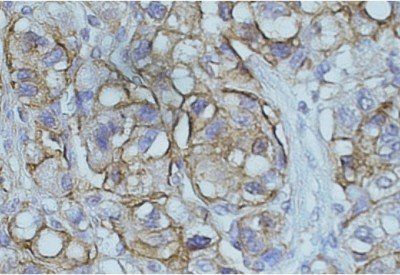 Goat anti-NDRG1 Antibody