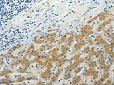 NDRG2 Antibody
