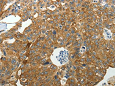 NDRG2 Antibody