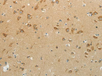 NDRG3 Antibody