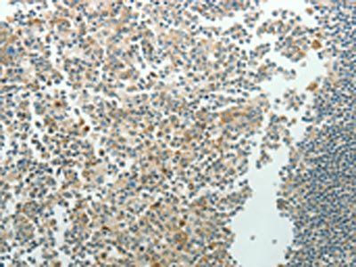 NDRG3 Antibody
