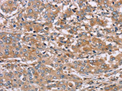 NDRG3 Antibody