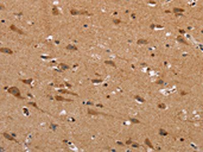 NDRG3 Antibody