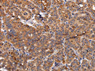 NDUFA1 Antibody