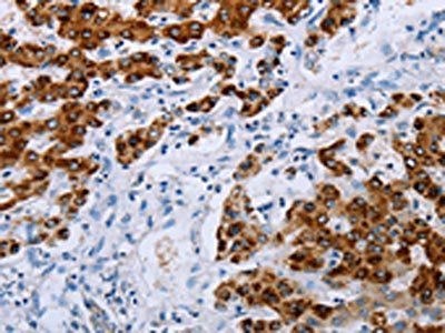 NDUFA12 antibody