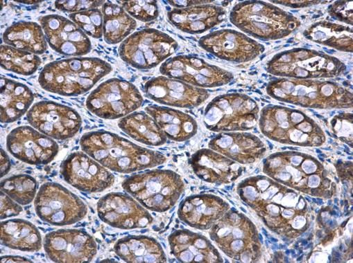 NDUFA12 antibody [N1C3]