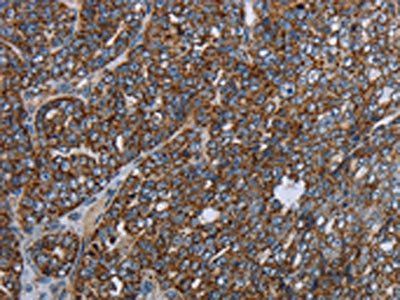 NDUFA13 Antibody