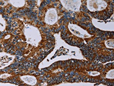 NDUFA4 antibody