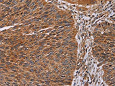 NDUFA8 Antibody