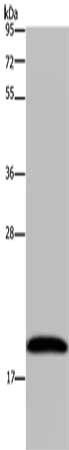 NDUFA8 Antibody