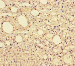 NDUFAF1 Antibody