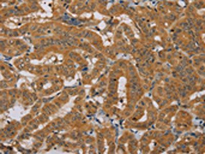 NDUFAF1 Antibody