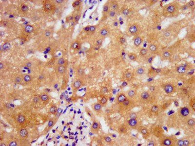 NDUFAF2 Antibody