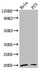 NDUFAF2 antibody