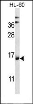 NDUFAF4 antibody