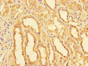 NDUFB11 Antibody