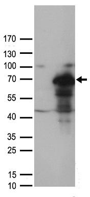 NDUFB3 Antibody