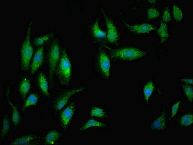 NDUFB5 Antibody