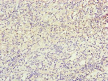 NDUFB5 Antibody