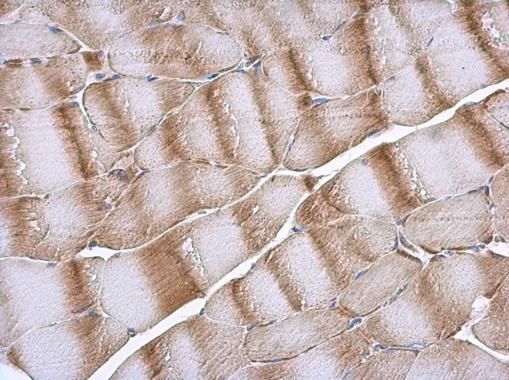 NDUFB5 antibody