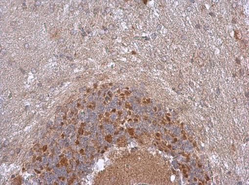 NDUFB5 antibody