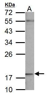 NDUFB5 antibody