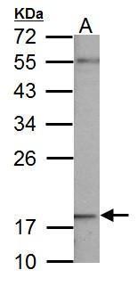 NADH:ubiquinone oxidoreductase subunit B5 Antibody