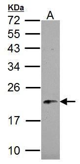 NADH:ubiquinone oxidoreductase subunit B5 Antibody
