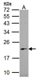 NDUFB5 antibody