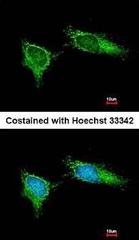 NDUFB5 antibody