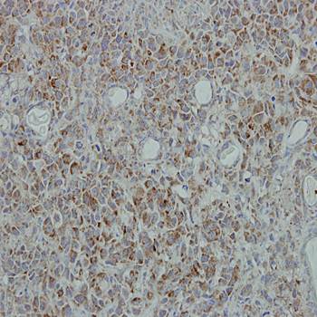 NDUFB5 antibody