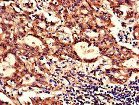 NDUFB6 Antibody