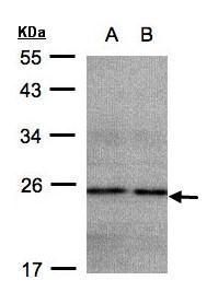 NADH:ubiquinone oxidoreductase subunit B9 Antibody