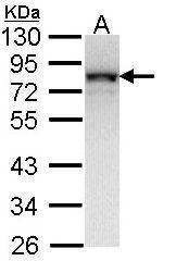 NADH:ubiquinone oxidoreductase core subunit S1 Antibody