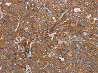 NDUFS2 Antibody