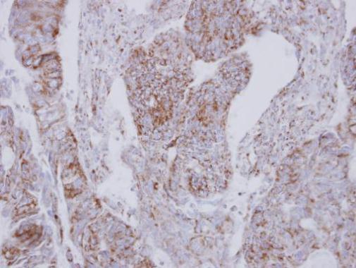 NADH:ubiquinone oxidoreductase core subunit S2 Antibody