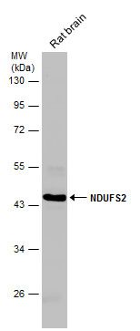 NADH:ubiquinone oxidoreductase core subunit S2 Antibody