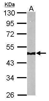 NADH:ubiquinone oxidoreductase core subunit S2 Antibody