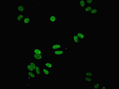 NDUFS3 Antibody