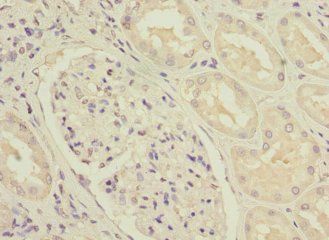 NDUFS3 Antibody