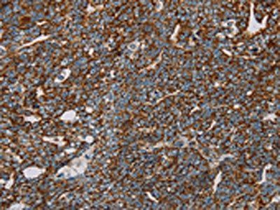 NDUFS3 Antibody