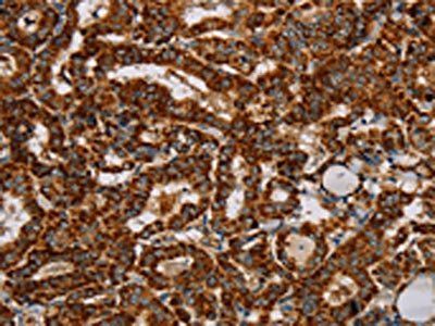 NDUFS3 Antibody