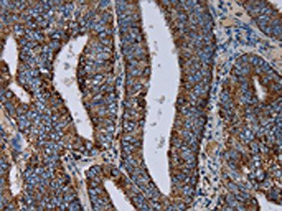 NDUFS4 Antibody