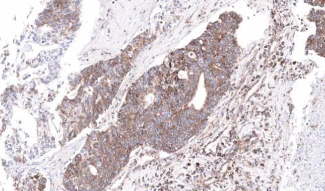 NADH:ubiquinone oxidoreductase subunit S4 Antibody