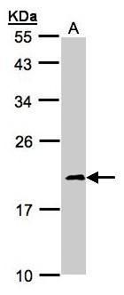 NADH:ubiquinone oxidoreductase subunit S4 Antibody