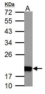 NADH:ubiquinone oxidoreductase subunit S4 Antibody