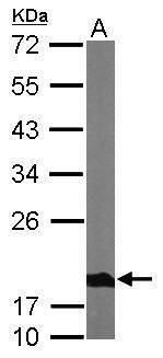 NADH:ubiquinone oxidoreductase subunit S4 Antibody