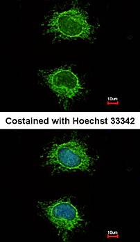 NDUFS4 antibody