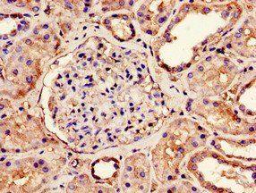 NDUFS4 Antibody