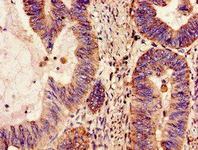 NDUFS4 Antibody